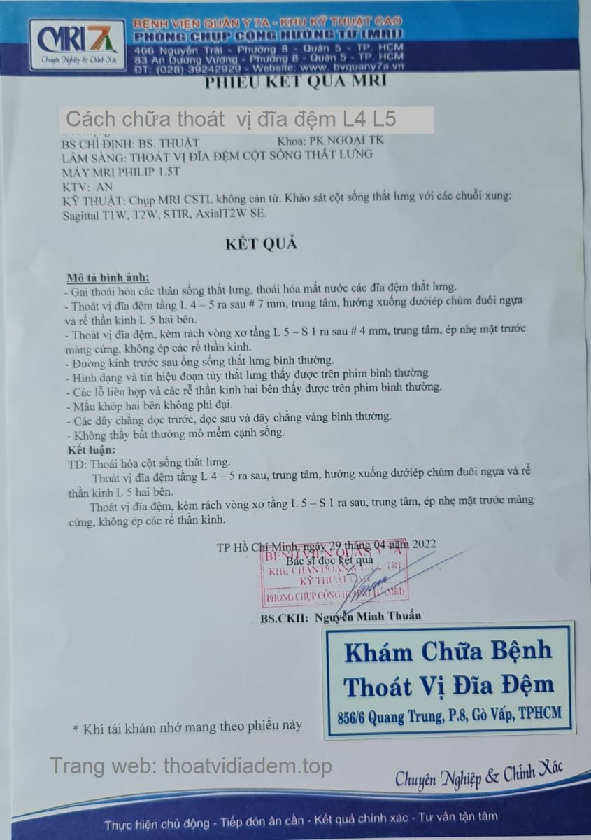 Cách chữa bệnh thoát vị đĩa đệm L4 L5